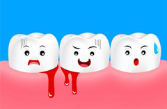洗牙时出血是怎么回事？